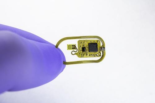 Для лечения депрессии в США человеку вживили чип Для лечения депрессии в США человеку вживили чип