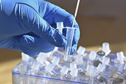 Эксперты прогнозируют новый подъём коронавирусной заболеваемости в РФ