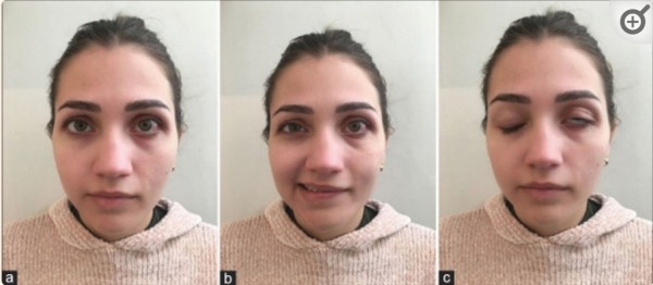 22 исследования доказывают вред вакцинации от COVID-19?