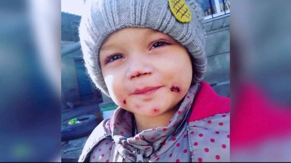 «За то, что не мужик»: продолжение истории искалеченного мальчика «За то, что не мужик»: продолжение истории искалеченного мальчика