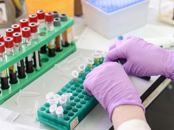 Анализы крови рассказали о стремительном старении человеческих органов