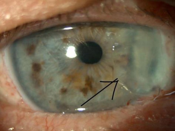 От роговицы до квантовых компьютеров: определена десятка ярких научных работ 2023