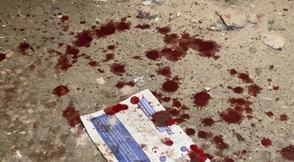 Военкор Георгий Медведев: и в Горловке, и в Донецке был целенаправленный теракт Военкор Георгий Медведев: и в Горловке, и в Донецке был целенаправленный теракт