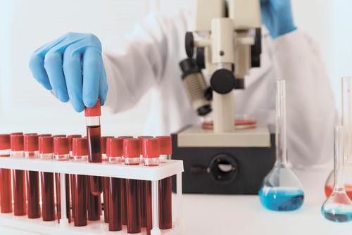 Группа крови практически не влияет на развитие недуга