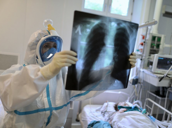 Ученые объяснили связь длительного коронавируса с тяжелым похмельем: проникает прямо в мозг