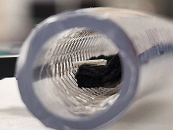 Человек – биохимический реактор: студентка разработала "вечный" мотор для кардиостимулятора