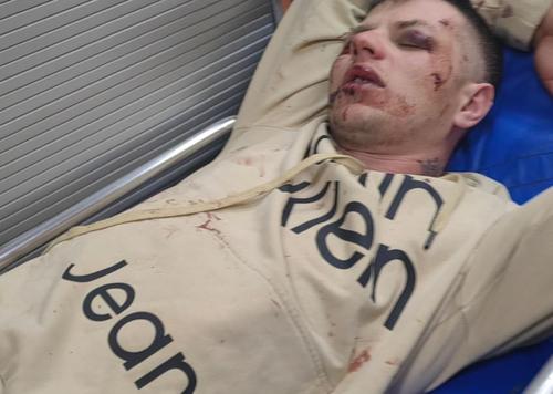 «Воевал за Россию, получи...»: в Ростове-на-Дону толпа отморозков избила до полусмерти ветерана СВО и его жену 