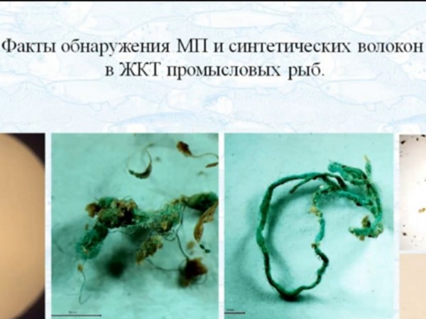 Микропластиковая цивилизация: российские ученые оценили влияние искусственных полимеров на человека