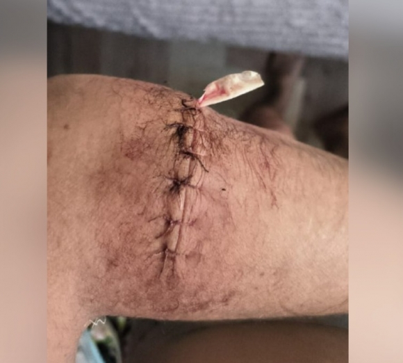 В Красноярском крае отморозки напали на бойца СВО и получили отпор — мужчине грозит срок за самооборону В Красноярском крае отморозки напали на бойца СВО и получили отпор — мужчине грозит срок за самооборону