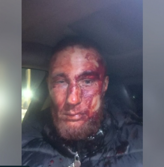 В Красноярском крае отморозки напали на бойца СВО и получили отпор — мужчине грозит срок за самооборону В Красноярском крае отморозки напали на бойца СВО и получили отпор — мужчине грозит срок за самооборону