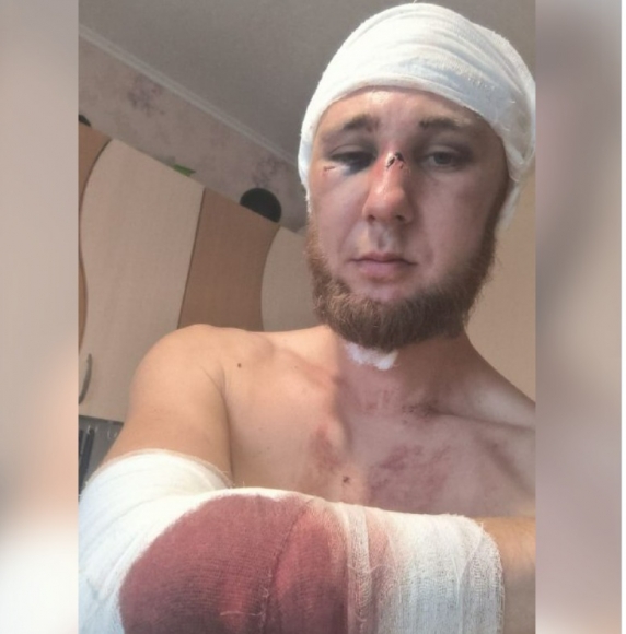 В Красноярском крае отморозки напали на бойца СВО и получили отпор — мужчине грозит срок за самооборону В Красноярском крае отморозки напали на бойца СВО и получили отпор — мужчине грозит срок за самооборону